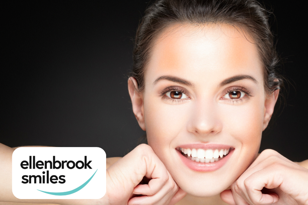 7 Facts About Dental veneers in Ellenbrook